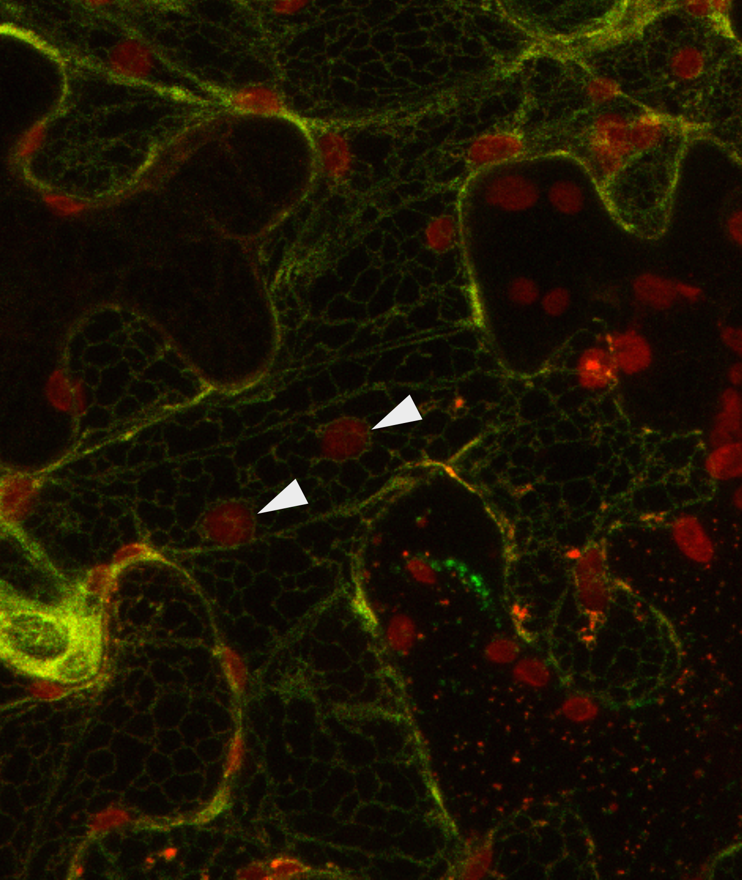 Understanding inter-organellar communication by contact sites