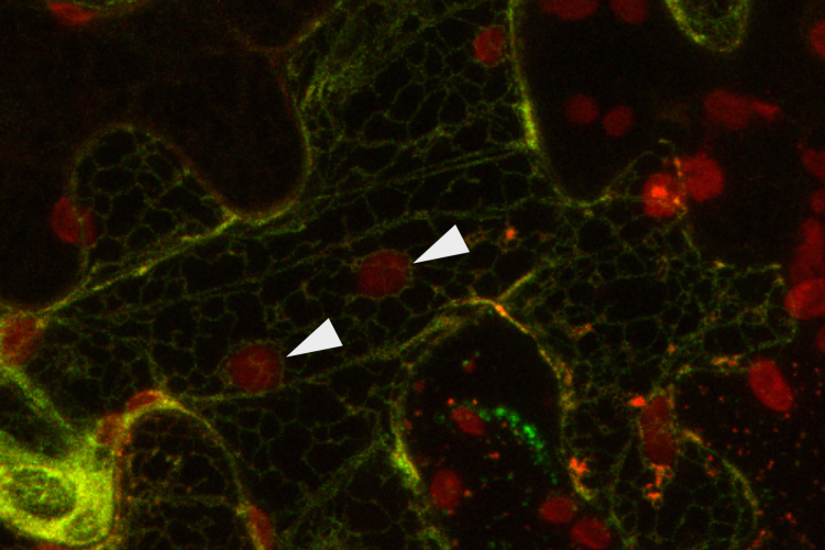 Understanding inter-organellar communication by contact sites